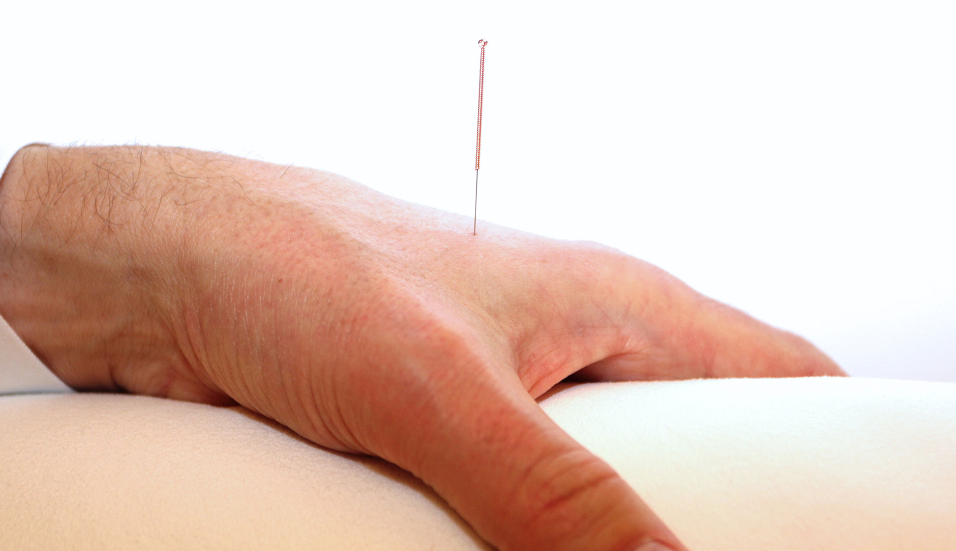 header akupunktur